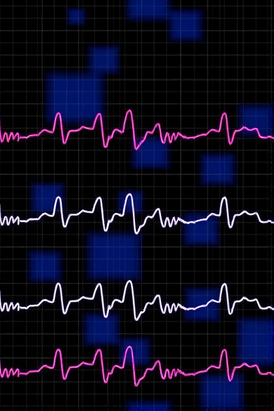 全新AI模型,心脏健康的未来在呼唤!